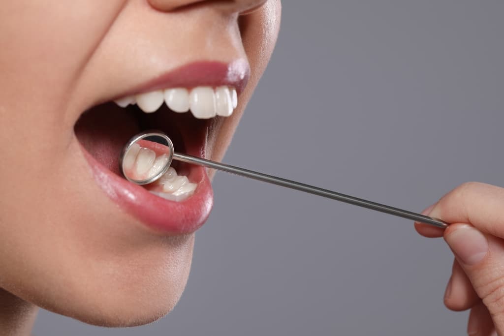 Qué es la piorrea o enfermedad periodontal