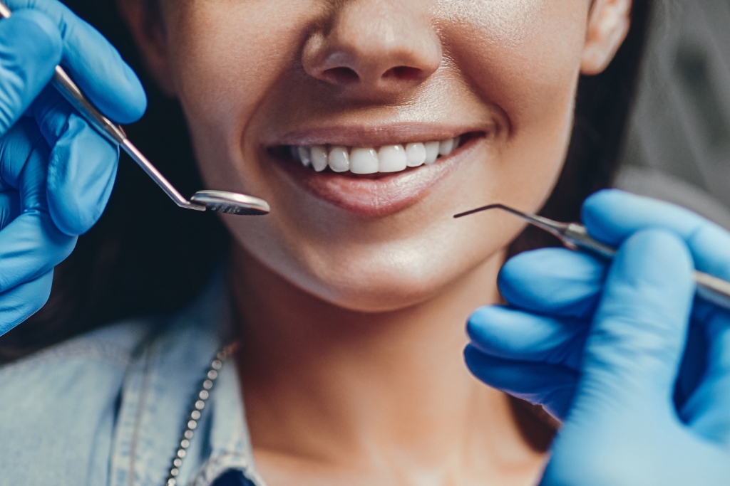 Limpieza dental: Qué es y beneficios